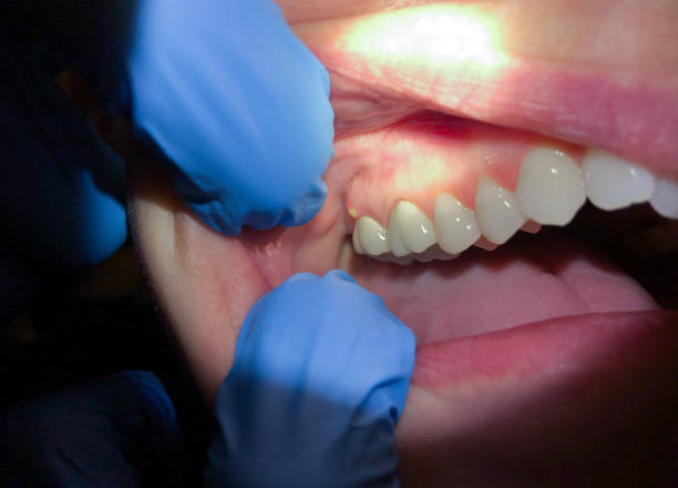 Best 24-Hour Emergency Dentist  in Whitfield, PA